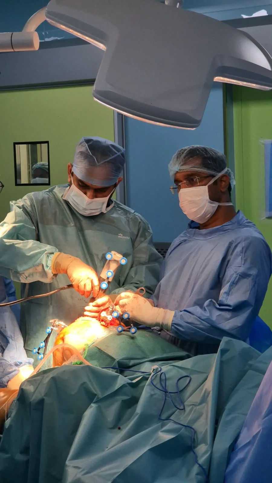 3D Pre-Operative Case Planning